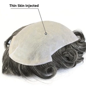 thinskin_injected-mens-hair-systems